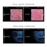 ANOTHER FACE Peptathenol Aqua Balance Cleansing Oil 300ml , Cleansing Foam 150ml (7 Options)