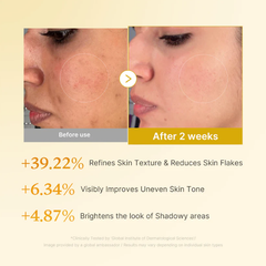 Medicube Kojic Acid Turmeric Resurfacing Toner 250ml (3 Options)