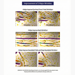 Dr.Pepti Peptide Volume Essence 2.0 Bubble-Type Peptide Foam Essence 100ml (3 Options)