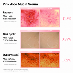 APRILSKIN Pink Aloe Mucin Serum 30ml (3 Options)