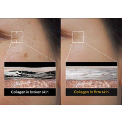 MEDIHEAL Capsule Patch (Vita / Retinol) – 60 Patches (7 Options)