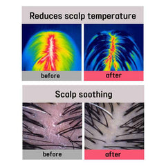 A'PIEU Raspberry Hair Vinegar 200ml, Mint Hair Vinegar 200ml, Hair Vinegar Shampoo 500ml (13 Options)