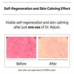 Dr.Reju-All Advanced PDRN Rejuvenating Cream 30ml (3 Options)