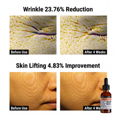 DERMA FACTORY PDRN 4% Ampoule 30ml ( 3 Options)