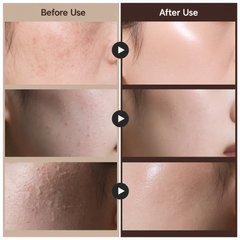 Dr.Reju-All Advanced PDRN Rejuvenating Cream 30ml (3 Options)