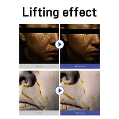 avajar Rejuvenating Double V Mask (5 Sheets) 3 Options