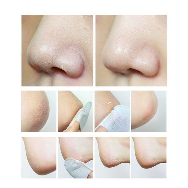 Medicube Zero Keratin Pad (3 Options)