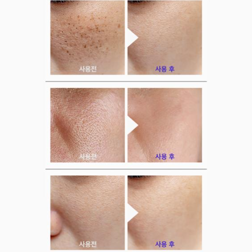 JBSARA Niacinamide Serum 30ml + Retinol Renew Serum 30ml