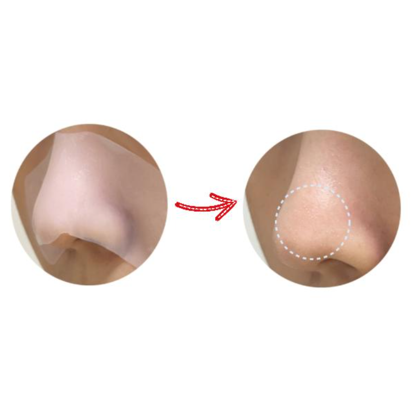 Eiio Anti-Pore Blackhead Kit 5 Sheets (3 Options)