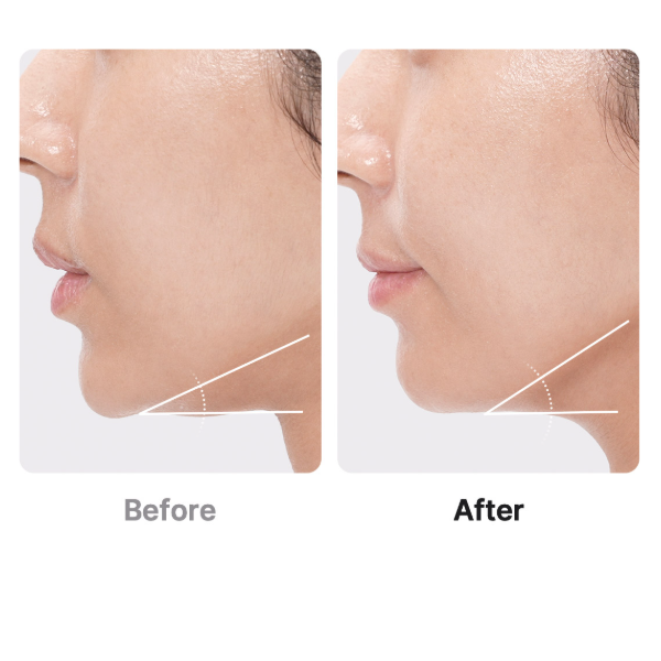 Medicube [AGE‑R] Booster Pro