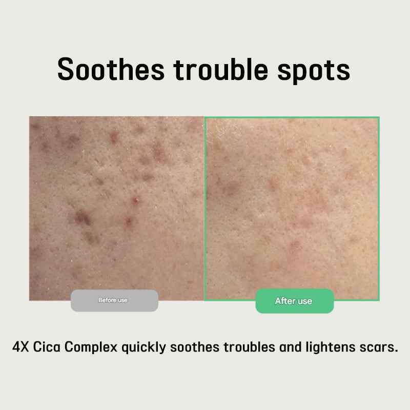 Purito Seoul Wonder Relief Centella Serum Unscented (3 Options)