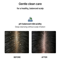 Zangmi Double Heartleaf Shampoo 750ml (2 options)
