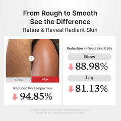 Medicube Hypochlorous Acid Rice Body Peel Shot 280ml (3 Options)