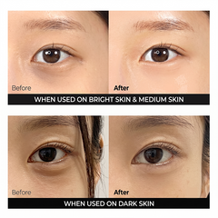 Dr.Melaxin Cemenrete Calcium Dark Spot Eye Cream 15g (3 Options)