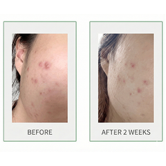 3W CLINIC LAB 3HA Revital Real Skin Care 5 Set