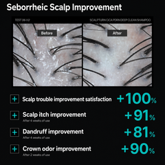 lilyeve Scalp:Turn CICA PDRN Deep Clean Shampoo 500ml / lilyeve Growturn Exosome Brush Ampoule 100ml ( 5 Options)
