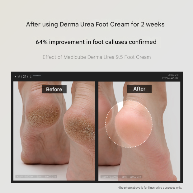 Medicube Derma Urea 9.5 Foot Cream (50 ml) (3 Options)