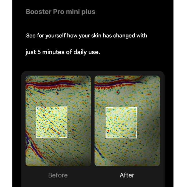 Medicube [AGE‑R] Booster Pro Mini Plus+