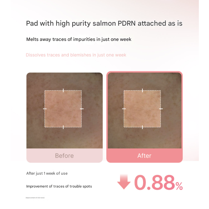 Medicube PDRN Pink Collagen Toning Gel Toner Pad 120 ml (70 pads) (3 Options)