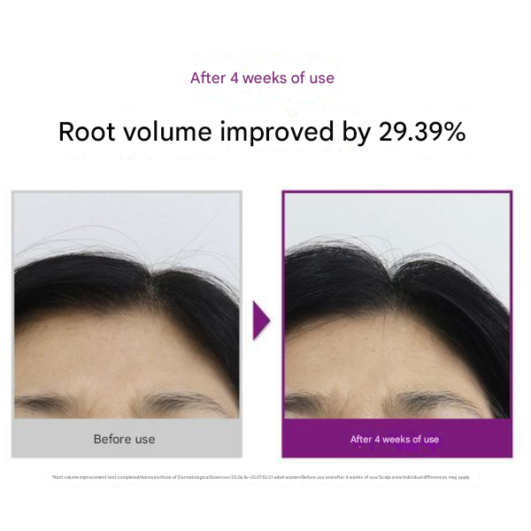 VT Reedle Shot Hair Boosting Ampoule 15ml (3 Options)
