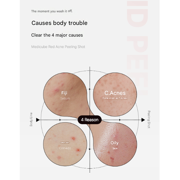 Medicube Body Pigmentation Intensive Care Set (Red Acne Body Peeling Shot 110g / Red Clear Capsule Body Lotion 230ml) (3 Options)