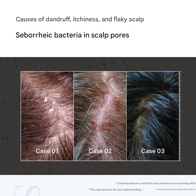 Medicube Soymint Scaling Shampoo (for Seborrheic/Oily Scalp) 490ml (3 Options)