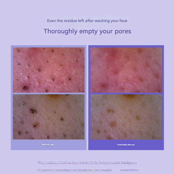 Rejuran Derma Healer Pore Tightening Toner Pad (220ml / 60 Pads) (3 Options)