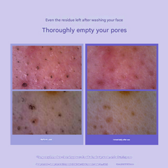 Rejuran Derma Healer Pore Tightening Toner Pad (220ml / 60 Pads) (3 Options)