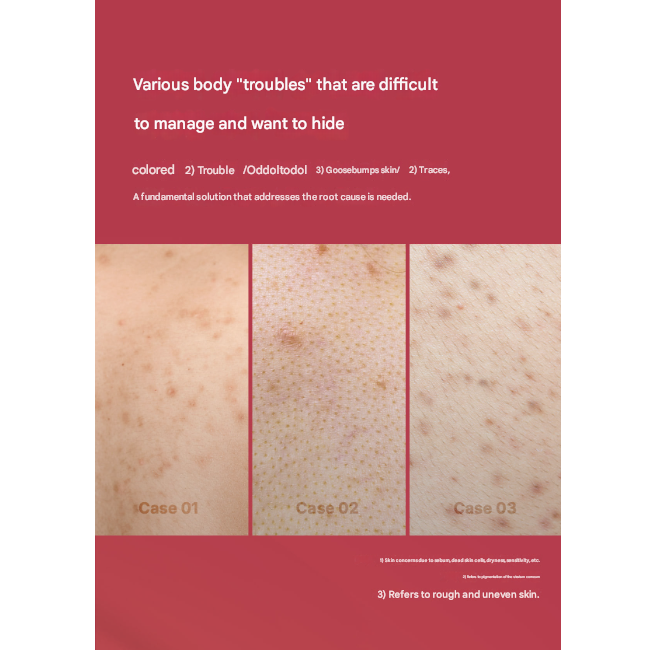 Medicube Body Pigmentation Intensive Care Set (Red Acne Body Peeling Shot 110g / Red Clear Capsule Body Lotion 230ml) (3 Options)