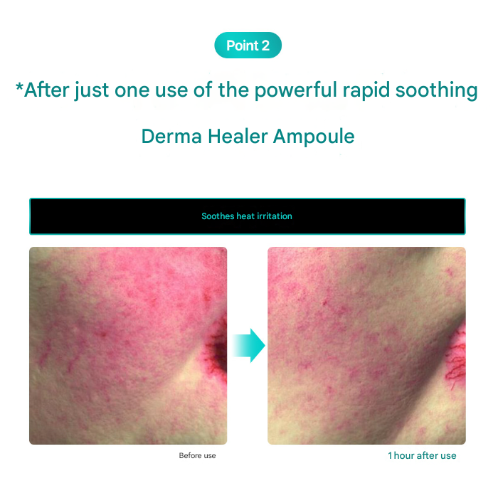 Rejuran Derma Healer Moisture Treatment Ampoule 30ml  (3 Options)