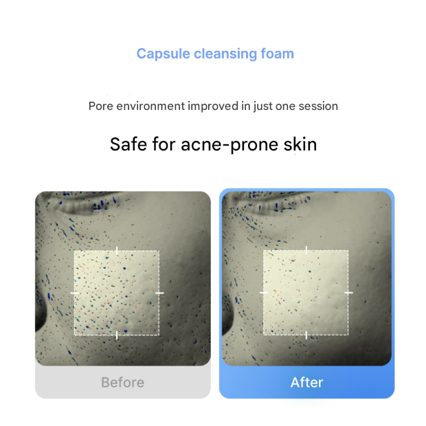 Medicube Zero Pore Clearing Capsule Foam Cleanser 120 g (3 Options)
