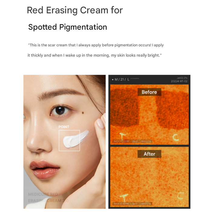 Medicube Red Erasing Cream 2.0 (50 ml) (3 Options)